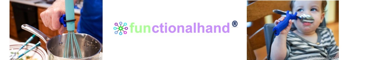 Functionele hand